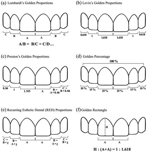 An Analysis of Maxillary Anterior Teeth Facial and Dental Proportions