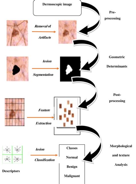 An Automated Skin Lesion Diagnosis by Using Image Processing Techniques