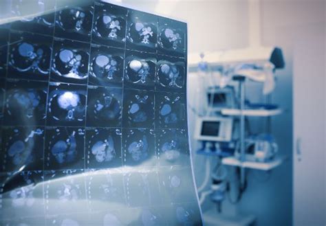 An Introduction to Different Types of MRI PBMC Health