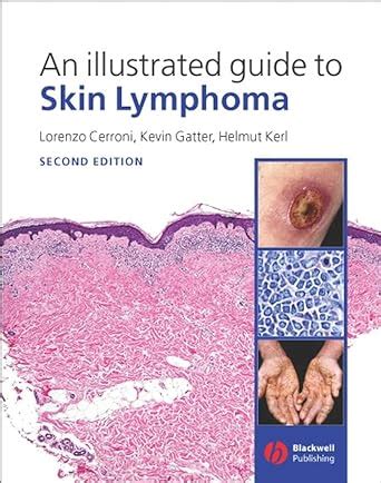An illustrated guide to skin lymphoma. - Album-lembrança da exposição iconográfica e bibliográfica bahiana.