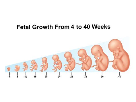 An x-ray should be performed to determine exactly how many fetus are growing so that you will know how many to expect