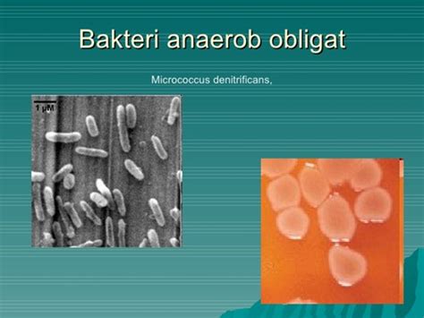 Anaerob bakterie