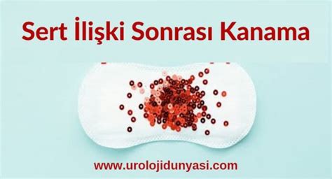 Anal Sex Sonrasi Kanama