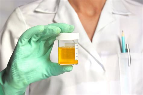 Analyse d’urine (ECBU) : comprendre les résultats