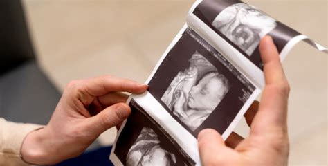 Anamoly Leaks XxX 🔥