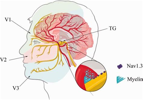 Anatomic relationship between trigeminal nerve and ... - PubMed