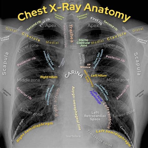 Anatomy, Thorax, Bronchial - PubMed