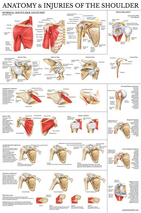 Download Anatomy And Injuries Of The Shoulder Anatomical Chart By Not A Book
