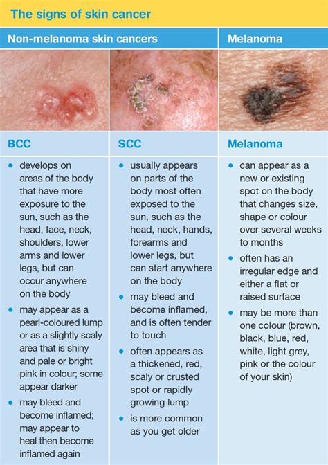 Anderson skin and cancer. Things To Know About Anderson skin and cancer. 