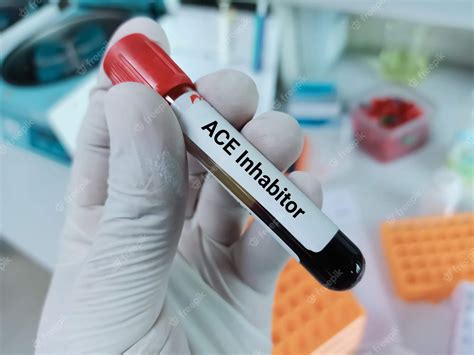 Angiotensin Converting Enzyme Test Best Pathology Lab and Diagnostic