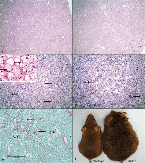 Animal models of NASH: Getting both pathology and metabolic …