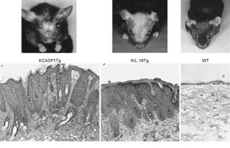 Animal models of atopic dermatitis - PubMed