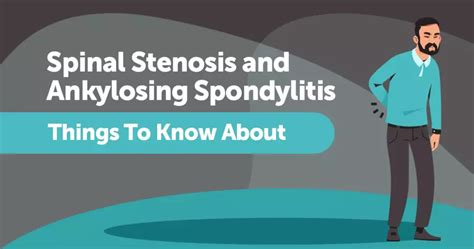 Ankylosing spondylitis and spinal stenosis What to know