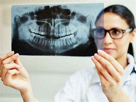 Ankylosing spondylitis and teeth problems What to know