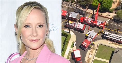 Anne Heche Is in a Coma and