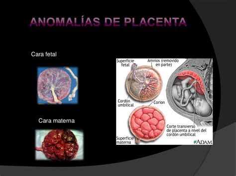 Anomalías morfológicas de la placenta y su significado clínico. - Annotated guide for rns to the texas nursing practice act.