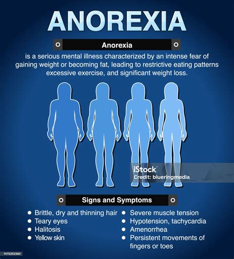 Anorexia orsak