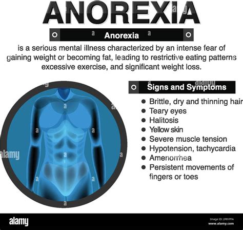 Anorexia sexy.  Anorexia means &ldquo;interrupted appetite.  Aug 5, 2021 · At Ge...