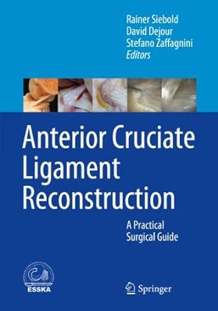 Anterior cruciate ligament reconstruction a practical surgical guide. - Stewart cálculo multivariable 7e manual de soluciones.