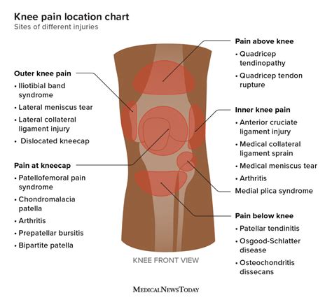 Anteromedial knee pain HealthTap Online Doctor