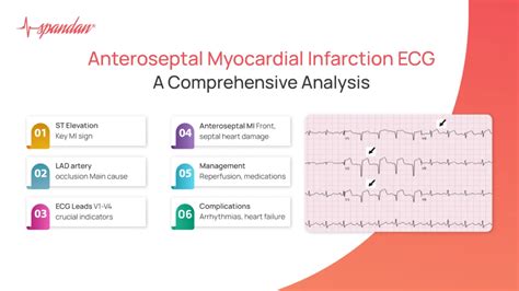 Anteroseptal Myocardial Manual Guide