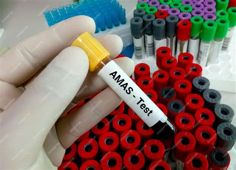 Anti Malignan Antibody Test for Cancer AMAS Test