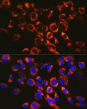 Anti-Rac1b Antibody Upstate®, from rabbit Sigma-Aldrich