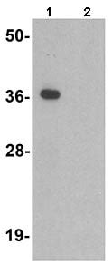 Anti-TMEM106A Western Blot Antibody Products Biocompare