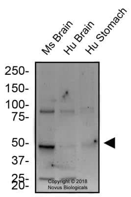 Anti-Tryptophan hydroxylase 2 Antibody Products Biocompare