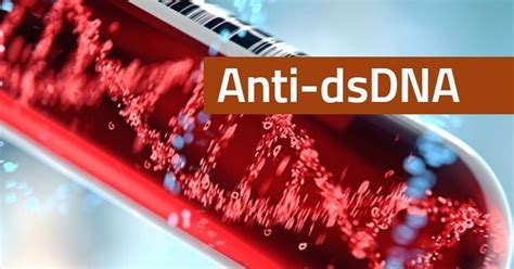 Anti-dsDNA - Lab Tests Online