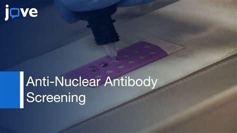 Anti-nuclear antibody screening using HEp-2 cells. - Europe PMC