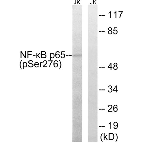 Anti-phospho-NF-kappaB p65 (pSer276) antibody produced in …