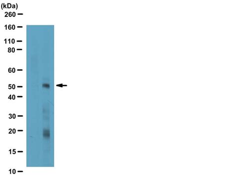 Anti-phospho-Smad3 (Ser423/425) Antibody - Sigma-Aldrich