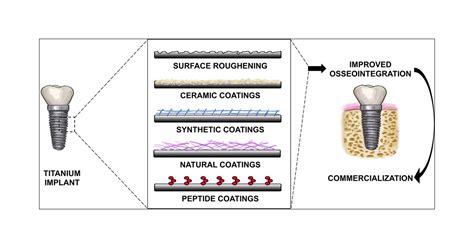 Antibacterial and bioactive coatings on titanium implant surfaces