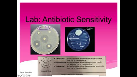 Antibiotic Sensitivity Lab answer - Antibiotic Sensitivity... - Course …