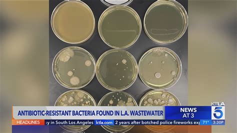 Antibiotic-resistant bacteria found for the first time in Los Angeles County