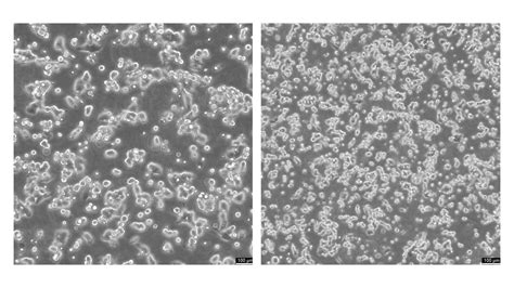 Antimycin A induced apoptosis in HCT-116 colorectal cancer cells ...