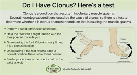 Anyone had Brisk reflexes and Clonus? : BFS - Reddit