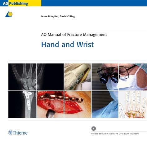 Ao manual of fracture management hand and wrist book and cd rom. - Monologos con alguien de mi mismo.