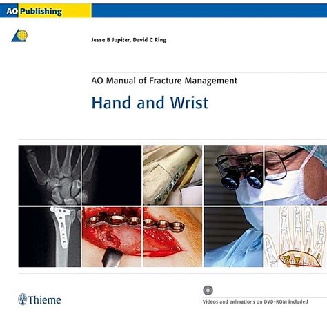 Ao manual of fracture management hand and wrist. - Reformismo por dentro en américa latina..