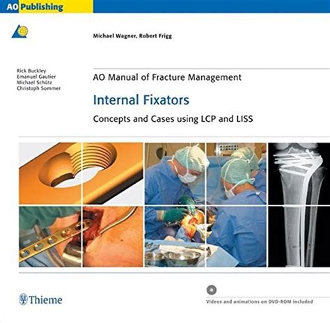 Ao manual of fracture management internal fixators concepts and cases using lcp liss. - Komatsu pc360lc 10 hydraulic excavator service repair manual.