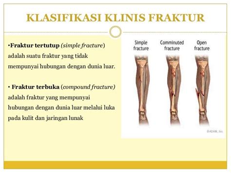 Kapolri perintahkan jajaran korlantas pedomani sop dalam setiap