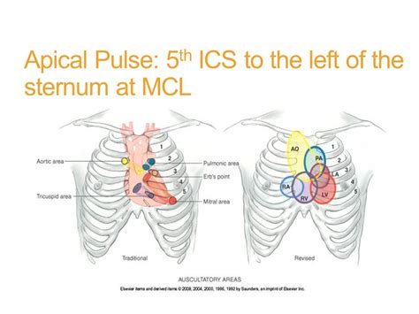 Apical pulse location. Things To Know About Apical pulse location. 