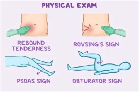 Appendicitis Test
