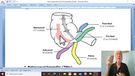 Appendicitis in Arabic 1 ( Appendicitis , part 1 ) , by Dr. Wahdan