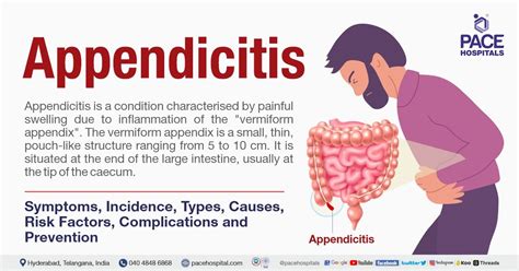 Appendix Example Images Layman Blog on Health Appendix, symptoms and