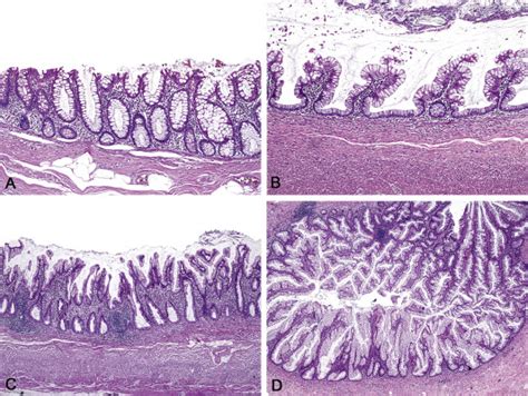 Appendix Lesions - UC Davis