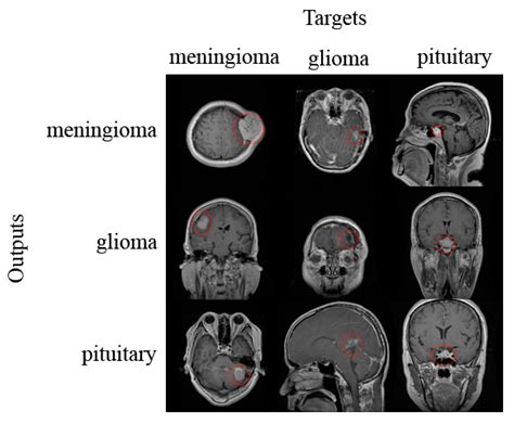Applied Sciences Free FullText Classification of Brain Tumors from