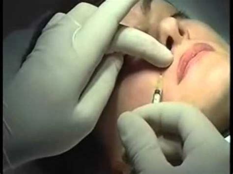 Aqualift dolgu 4 YouTube. 