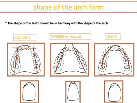 Arch Form Shape Tooth